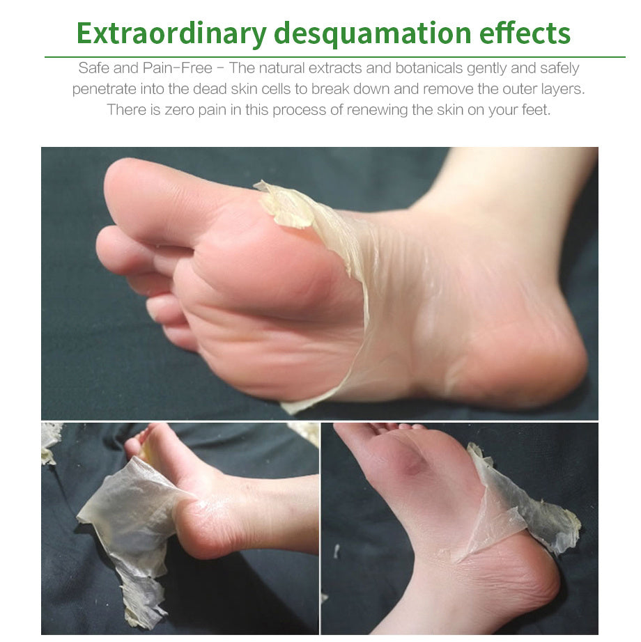 Foot peel mask